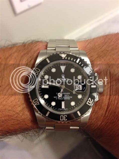 bodybump rolex